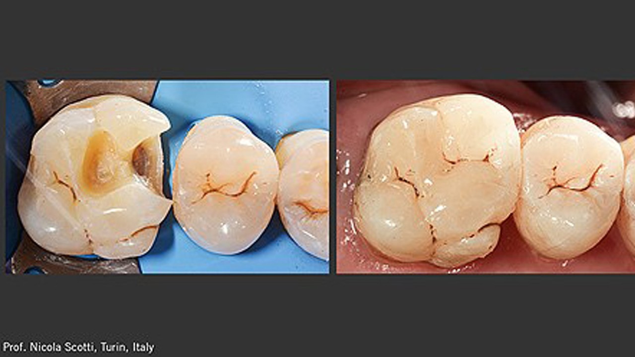 Charisma Diamond ONE